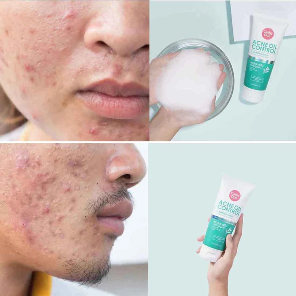 Cathy Doll Ance Oil Control Facial Foam 150ml